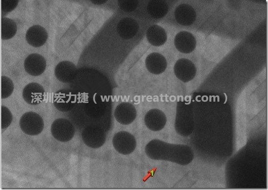 BGA因為焊墊變小，造成錫膏過多而最終形成焊接短路的結(jié)果。